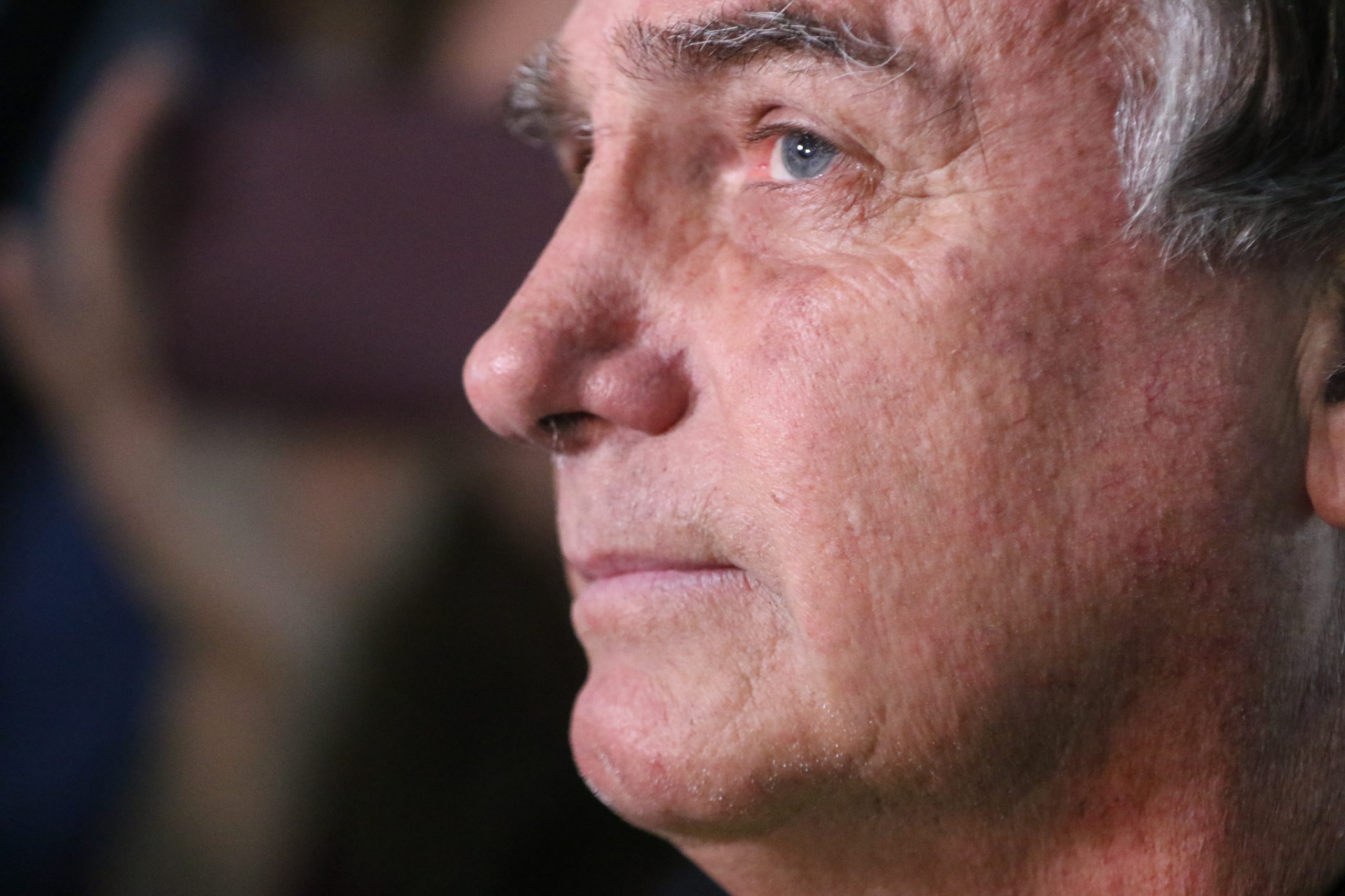 Bolsonaro ficará de repouso em casa durante mês de julho